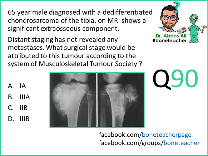 65 year male diagnosed with a dedifferentiated chondrosarcoma of the tibia