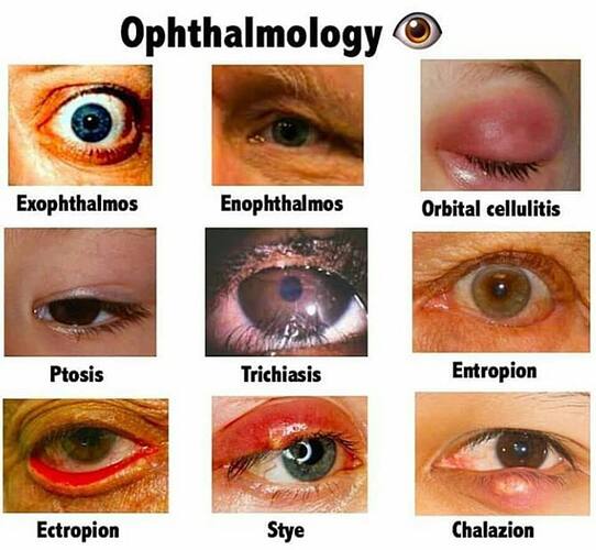 Most%20common%20diseases%20of%20Ophthalmology