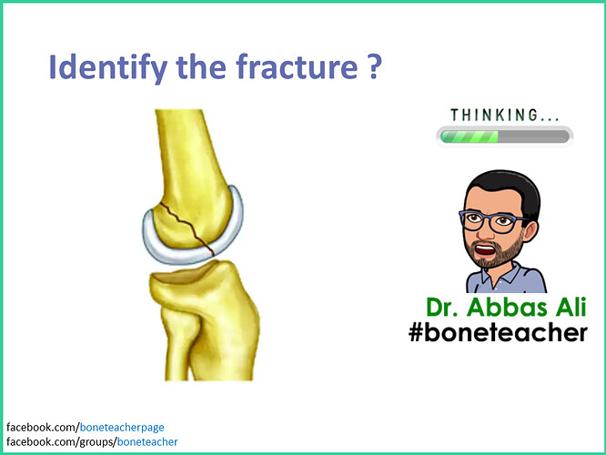 Identify the fracture
