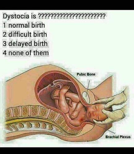 Dystocia%20is%20normal%20birth