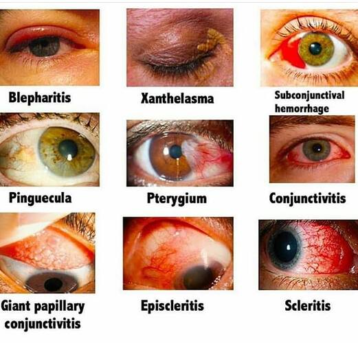 Most%20common%20diseases%20of%20Ophthalmology1