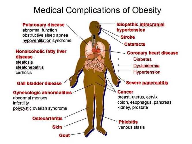 Medical%20Complications%20of%20Obesity