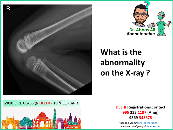 what is the abnormality on the xray