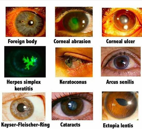 Most%20common%20diseases%20of%20Ophthalmology2