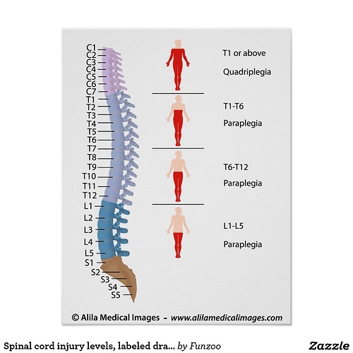 Spinal Cord Injury Levels Labeled Drawing Poster Zazzle Com In 2020