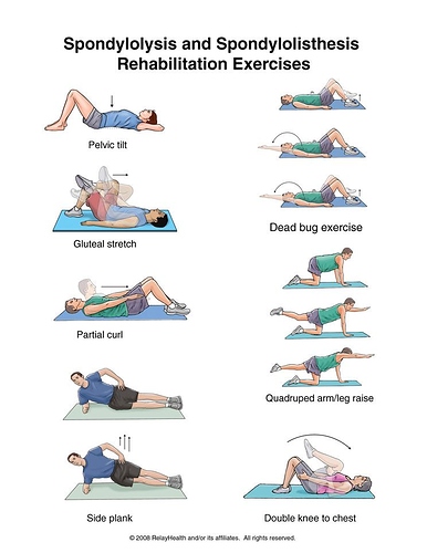 Exercise For Flat Stomach Spondylolisthesis Rehabilitation
