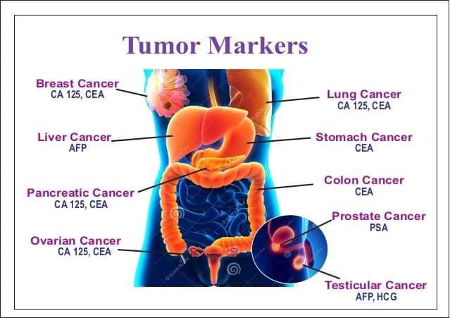 Tumor%20Markers
