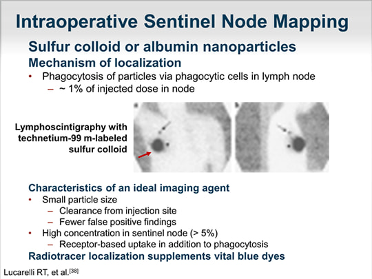 INTRAOPERATIVE%20SENTINEL%20NODE%20MAPPING