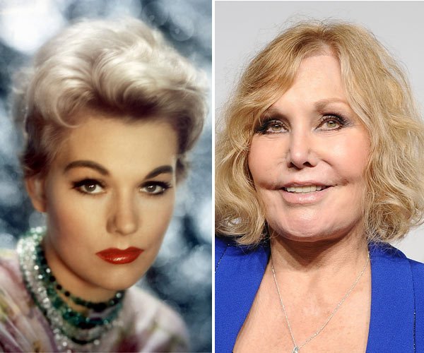 kim-novak-before-and-after-plastic-surgery-