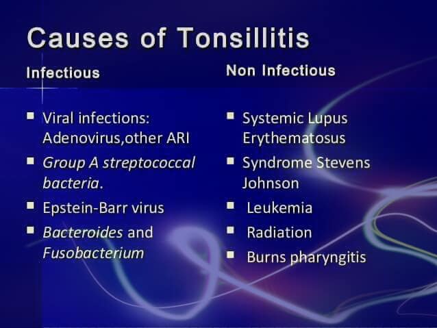 Tonsillitis4