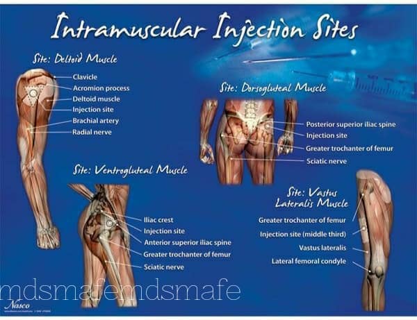 Intramuscular%20injection%20sites
