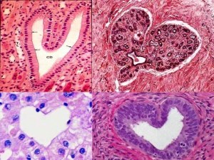 LifeofaMedStudent – when you use histology slides to spark romance