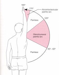 Pt Management Of Shoulder Impingement Syndrome With Research