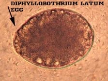 Diphylloothrium Latum EGG