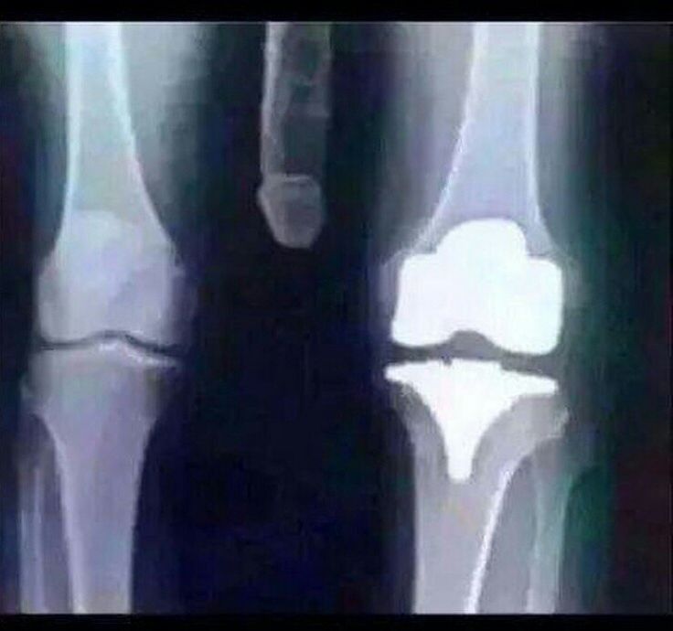 My Knee Xray Boy Its Sore Radiology Humor X Ray Xray Humor - Memes -   the Best Medical Forum for Medical Students and Doctors  Worldwide