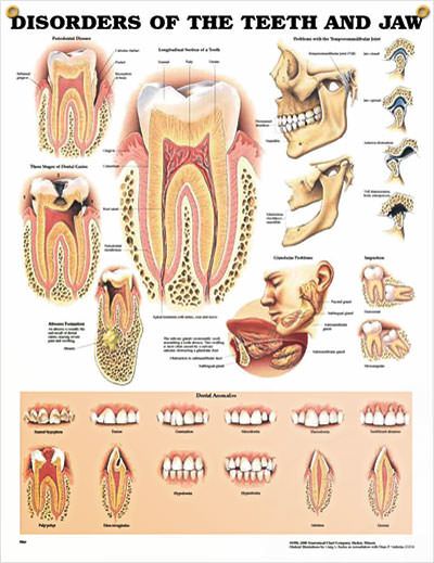 Disorders of the teeth and jaw